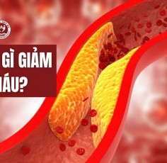 Uống gì để giảm mỡ máu? Bật mí 5 dược liệu quen thuộc, dễ tìm